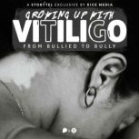Growing Up With Vitiligo, I Was Bulli..., RICE media