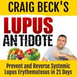 Lupus Antidote, Craig Beck