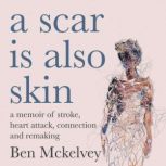 A Scar is Also Skin, Ben Mckelvey