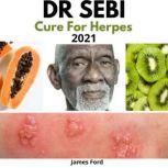 Dr. Sebi Cure for Herpes 2021 How to Naturally Cure Herpes Simplex Virus with Dr. Sebi's Alkaline Diet, Nutritional Guide, Food List and Herbs, James Ford