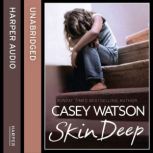 Skin Deep All she wanted was a mummy, but was she too ugly to be loved?, Casey Watson