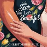 The scar you left is beautiful, Christopher Ruiz