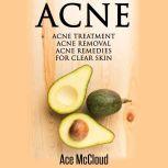 Acne Acne Treatment Acne Removal A..., Ace McCloud