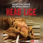What You Need to Know about Head Lice..., Nancy Dickmann