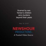 Scarred by war, Yemens children carr..., PBS NewsHour