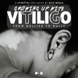 Growing Up With Vitiligo, I Was Bulli..., RICE media