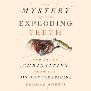 The Mystery of the Exploding Teeth: And Other Curiosities from the History of Medicine, Thomas Morris
