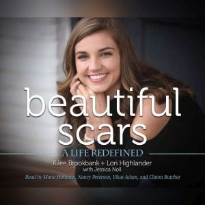 Beautiful Scars, Kilee Brookbank