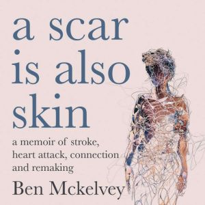A Scar is Also Skin: A memoir of stroke, heart attack and remaking