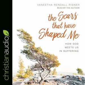 Scars That Have Shaped Me, Vaneetha Rendall Risner