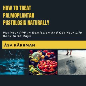 How To Treat Palmoplantar Pustulosis ..., Asa Karrman