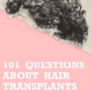101 questions about hair transplants, Artur Kierach