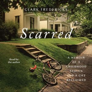 Scarred: A Memoir of a Childhood Stolen and a Life Reclaimed